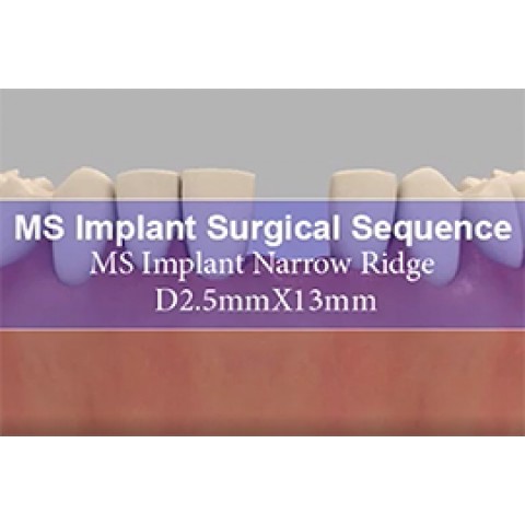 Имплантаты MS 