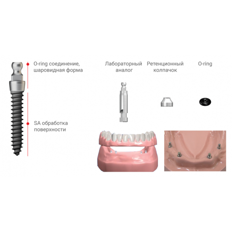 Имплантат MS SA типа Denture
